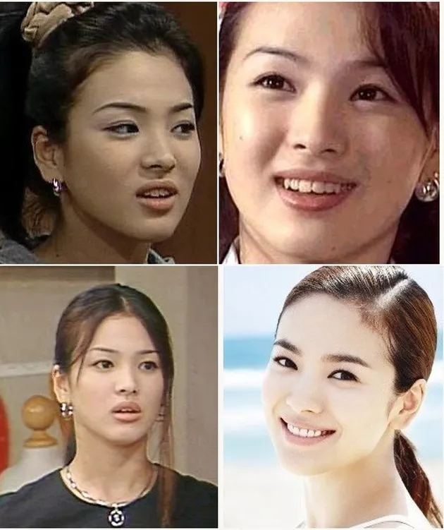 seleb korea memperbaiki gigi