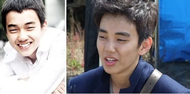 seleb korea memperbaiki gigi