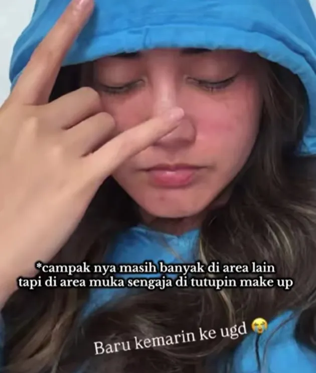 <nil>