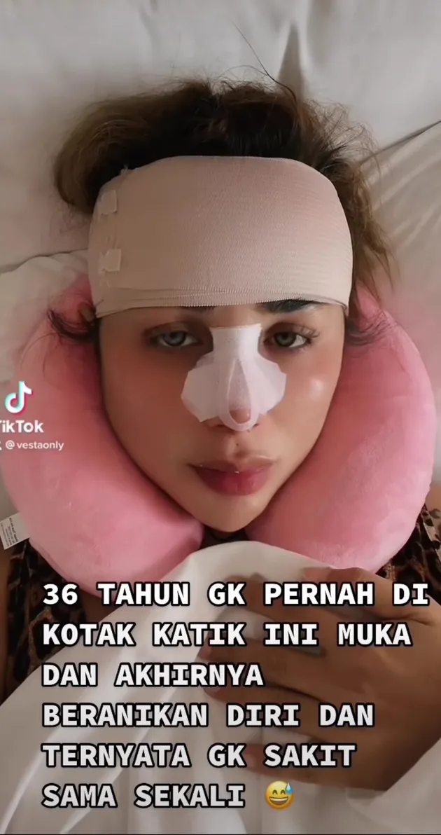 Transgender Gebby Vesta Perdana Oplas Wajah