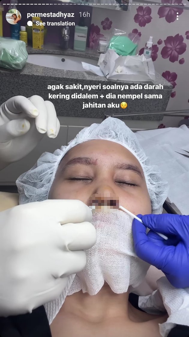 Criticism from Netizens for Swimming After Nose Implant Surgery, 11 Photos of Permesta Dhyaz After Stitches Removed Accompanied by Farida Nurhan