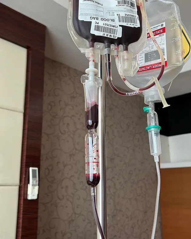 Ruben Onsu Dirawat di Rumah Sakit