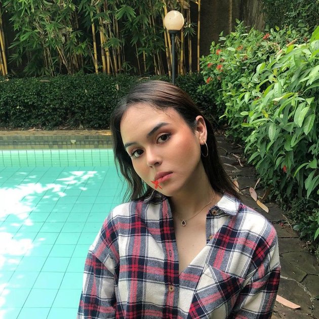 Inilah sosok Laura Anna yang ramai jadi buah bibir publik karena kecelakaan yang pernah menimpanya pada 2019 lalu.