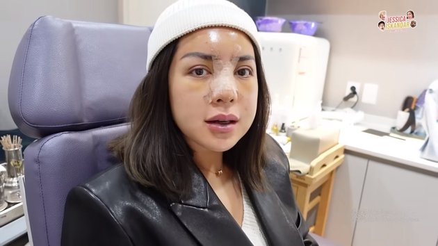 Unable to Breathe Normally, Latest Condition of Jessica Iskandar After Nose Surgery - Weird Face with Chubby Cheeks Like a Cute Woman