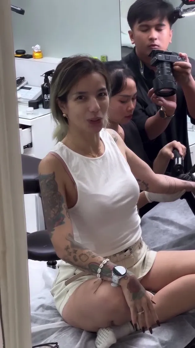 Sheila Marcia Proses Laser Tato