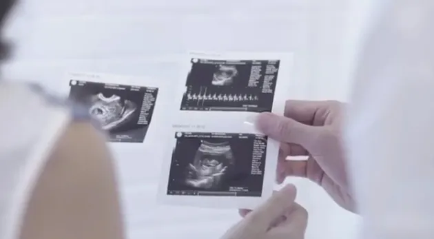 Celine Evangelista hamil