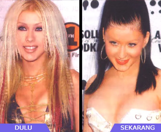 Selebritis dan Operasi Payudara
