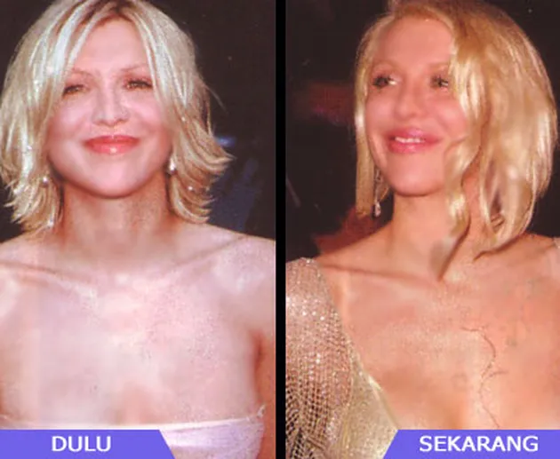 Selebritis dan Operasi Payudara