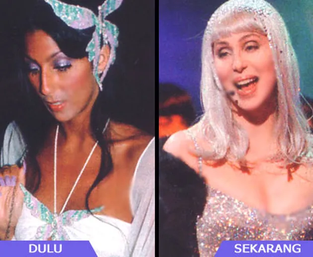 Selebritis dan Operasi Payudara