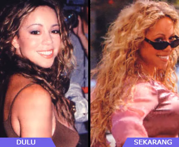 Selebritis dan Operasi Payudara