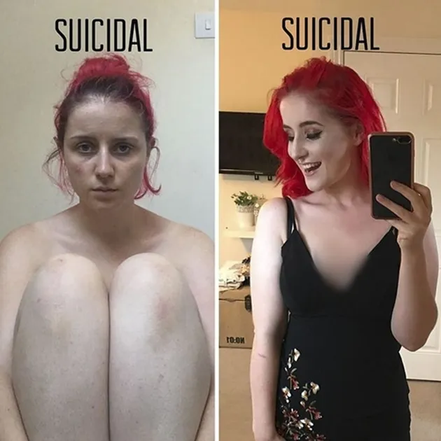 Face of Depression