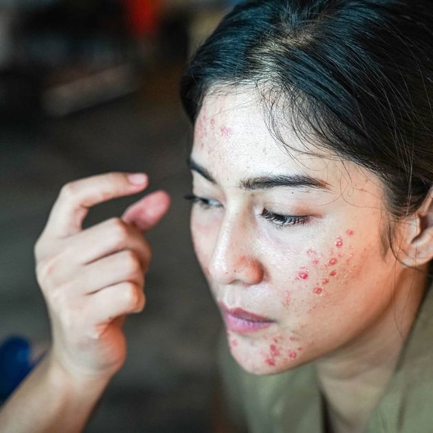 Appearing Acne, Check Out 8 Latest Photos of Dian Sastro that Will Make You Amazed