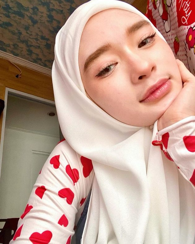 After Removing the Veil, Here's the Latest Portrait of Inara Rusli Who Dares to Show Her Beautiful Face with a Selfie Photo - Called an Angel Without Wings