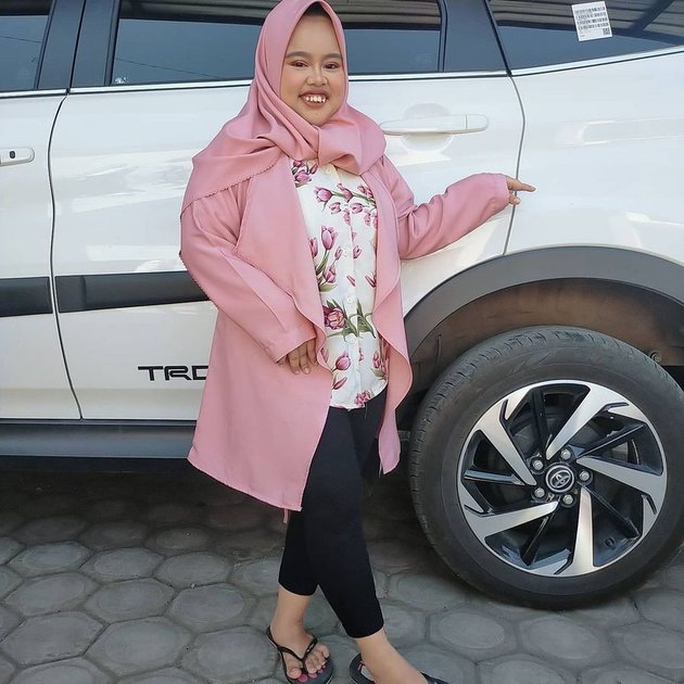 Viral Because of Calling Free Fire Ayam Pedas, Here are 7 Latest Pictures of Kekeyi Getting Thinner - Confident with Red-White Lipstick