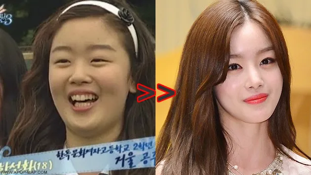 WAJAH 10 SELEB KOREA BERUBAH DRASTIS, PUBER ATAU OPERASI ...
