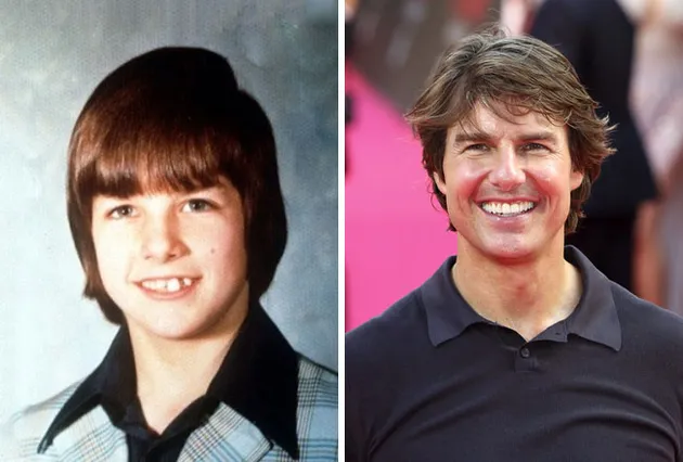 Waktu Kecil Cupu, 11 Seleb Hollywood Ini Malah Terkenal Ganteng!