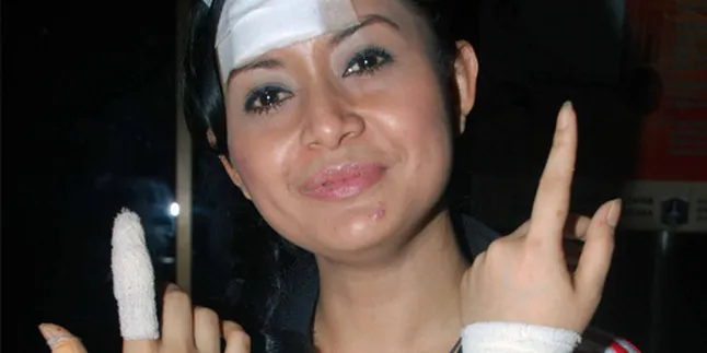 Edies Adelia Jadi Korban Ledakan Kompor