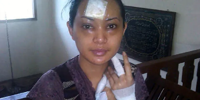 Edies Adelia Trauma Nyalakan Kompor