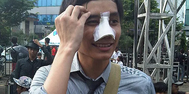 Pemukulan Lale Maliq and D Essentials Berakhir Damai