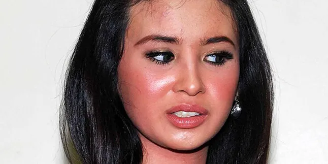 Kulit Sensitif, Ayu Shita Rajin ke Dokter