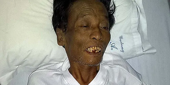 Diet Cholik Berujung Derita