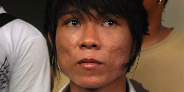 Dokter Bantah Andika 'Sakaw'