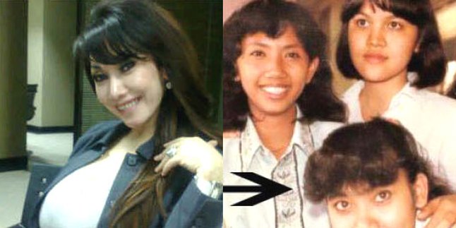 Wajah Melinda Dee: Before vs After!