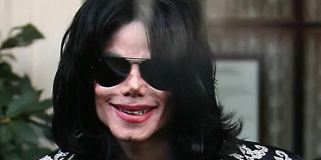 Michael Jackson Mengidap Herpes?