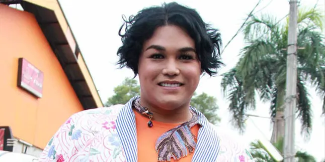 Sedot Lemak, Ivan Gunawan Turun 25 Kilo!