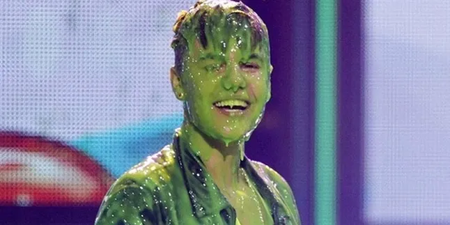 Gara-Gara Slime, Justin Bieber Cukur Habis Rambutnya?