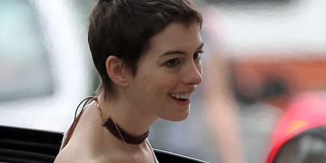 Anne Hathaway Alami Cedera Pergelangan Tangan
