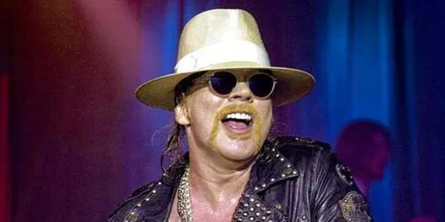 Fans Slash Dipaksa Topless di Konser Guns N Roses
