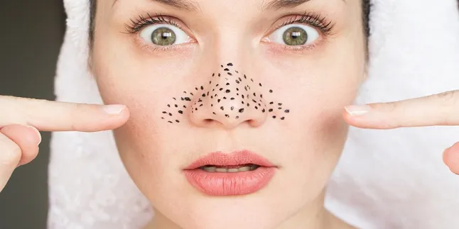 10 Cara Ini Ampuh Hilangkan Komedo Secara Alami Hanya Dalam 1 Hari, Simak!