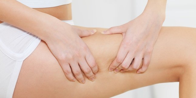 10 Natural Ways to Remove Stretch Marks Without Medical Assistance