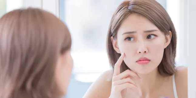 20 Metode Bagaimana Cara Menghilangkan Jerawat Biar Tampil Secantik Selebriti