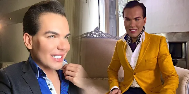 30 Kali Operasi Plastik, Rodrigo Alves Habiskan Miliaran Rupiah