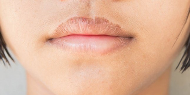 7 Penyebab Bibir Kering dan Pecah-Pecah, Hati-Hati Bisa Disebabkan Kebiasaan Sepele