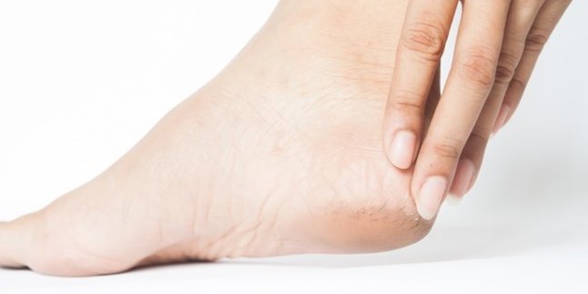 7 Causes of Cracked and Prevention of Cracked Feet