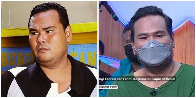 7 Photos of Fahmi Bo 'Lupus' Condition, Once Roaming on TV Screen, Now Surviving by Selling Bread