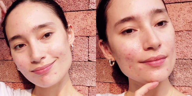 8 Photos of Tatjana Saphira that Receive Praise, Showing Her Face Without Makeup and Acne