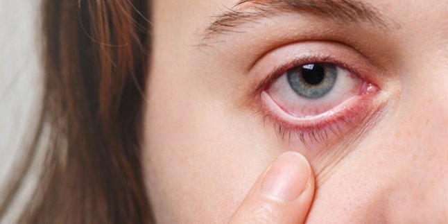 9 Penyebab Mata Merah yang Paling Umum Terjadi, Kenali Cara Mencegahnya