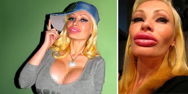 Agar Mirip Sex Doll, Model Hot Ini Rela Oplas Besar-Besaran Agar Mirip Sex Doll, Model Hot Ini Rela Oplas Besar-Besaran