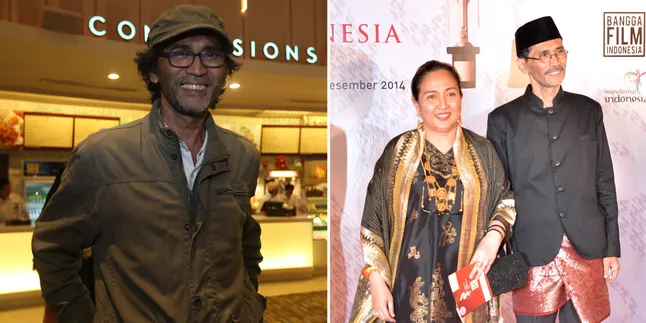 Alex Komang Kritis Hadapi Kanker Hati di Semarang