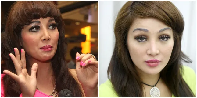 Alis Hancur, Fifie Buntaran Terpaksa Dilaser