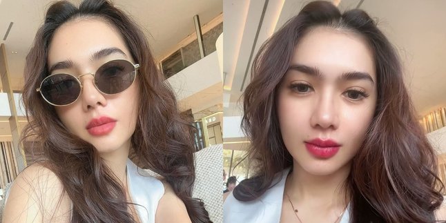 Angel Karamoy Shows Her Face Again After Plastic Surgery, Receives Various Reactions
