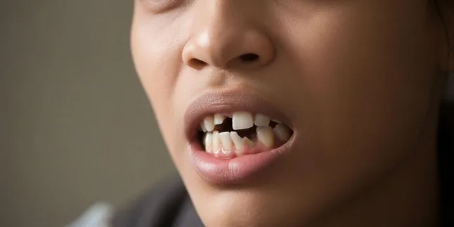 Arti Mimpi Gigi Copot Sebagian: Makna dan Tafsir Lengkap Arti Mimpi Gigi Copot Sebagian: Makna dan Tafsir Lengkap