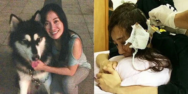 Artis China Ini Digigit Anjing Michelle Ye Hingga Luka Parah