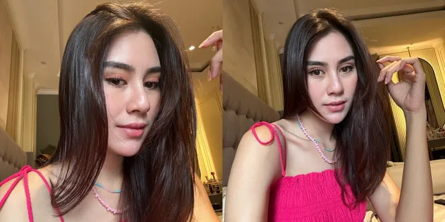 Bantah Lakukan Operasi Plastik, Syahnaz Sadiqah Tegaskan Tampil Beda Karena Perkara Angle Camera