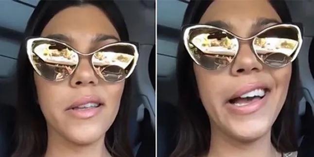 Begini Wajah Kourtney Kardashian Setelah Perawatan Gigi