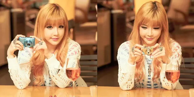 Bentuk Dagu Bengkok, Bom 2NE1 Lakukan Operasi Plastik?